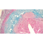 Masson's Trichrome